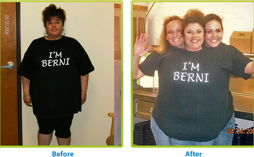 before and after diet. HCG Diet Before and After
